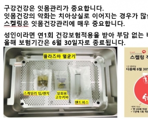 스케일링 6월안…