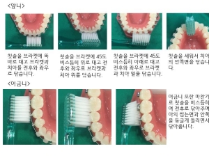 교정환자의 양…